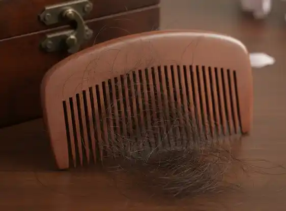 أخطاء شائعة بعد زراعة الشعر