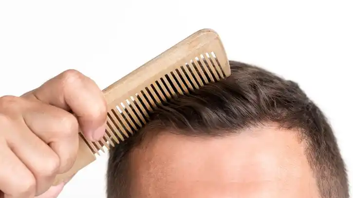 أسباب تساقط الشعر عند الرجال وعلاجه