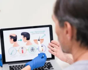 الفرق بين تقنية DHI وFUE Sapphire