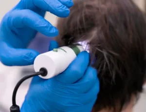 المتابعة بعد الزراعة وأهميتها