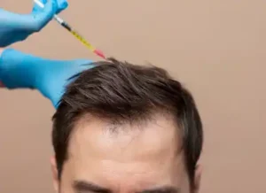 تقنيات حديثة في زراعة الشعر للرجال والنساء