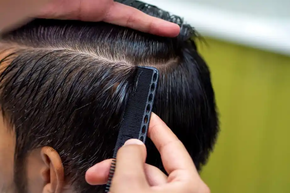 زراعة الشعر بدون حلاقة المزايا والخطوات