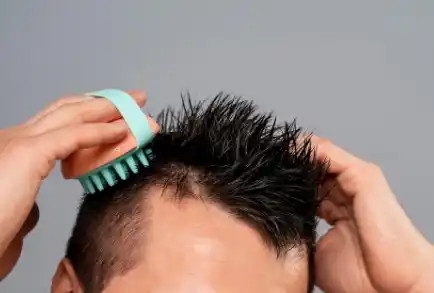 زراعة الشعر بضمان مدى الحياة