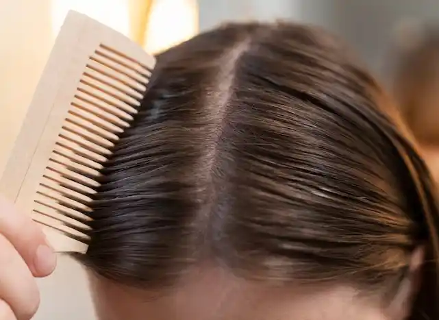 زراعة الشعر في تركيا