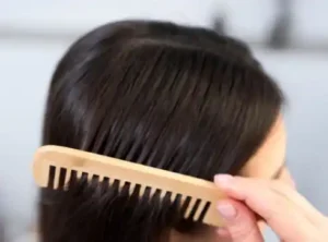 زراعة الشعر للنساء بدون حلاقة