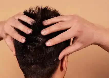 هل زراعة الشعر مؤلمة؟