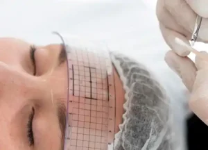 هل نتائج زراعة الحواجب دائمة؟