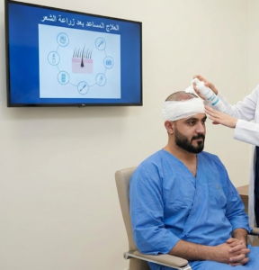 العلاج المساعد بعد زراعة الشعر