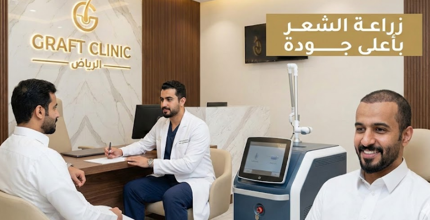 زراعة الشعر بأعلى جودة بالرياض